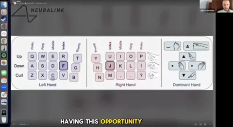 Neuralink का कमाल: मरीज ने दिमाग से टाइप किए 141 शब्द प्रति मिनट