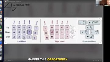 Neuralink Patient Hits 141 WPM With His Mind