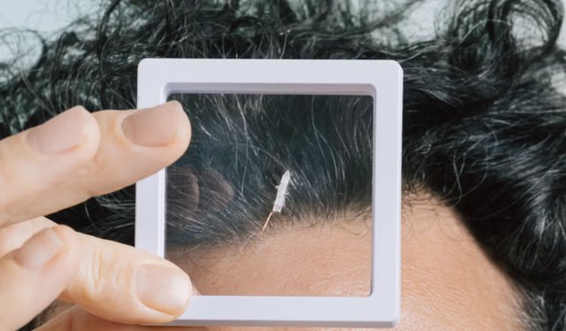 Robeauté's Rice-Sized Robot Navigates Brain to Fight Tumours