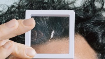 Robeauté's Rice-Sized Robot Navigates Brain to Fight Tumors